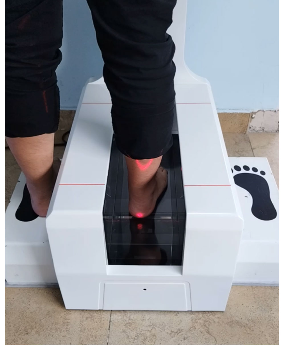 Jingyixun 3D laser foot scanner foot measuring instrument intelligent energy foot Flat feet evaluation deposit