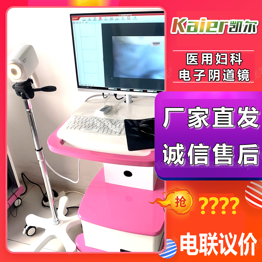 Gynecological vaginoscope Digital electronic Colposcopy Optical vaginal endoscope 2023