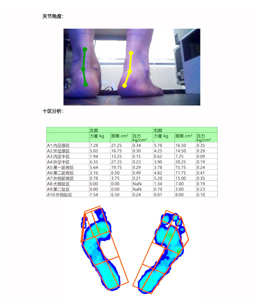 Foot pressure sensor gait analysis equipment for correcting insoles Customized foot health assessment deposit