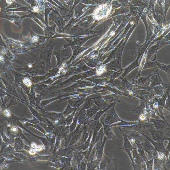 大鼠主动脉平滑肌细胞 Rat Aortic Smooth Muscle Cells 毕合生物 产品关键词:大鼠主动脉