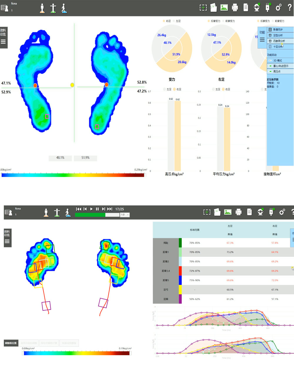 Gait analysis insole production equipment plantar pressure system foot valgus correction Flat feet evaluation deposit