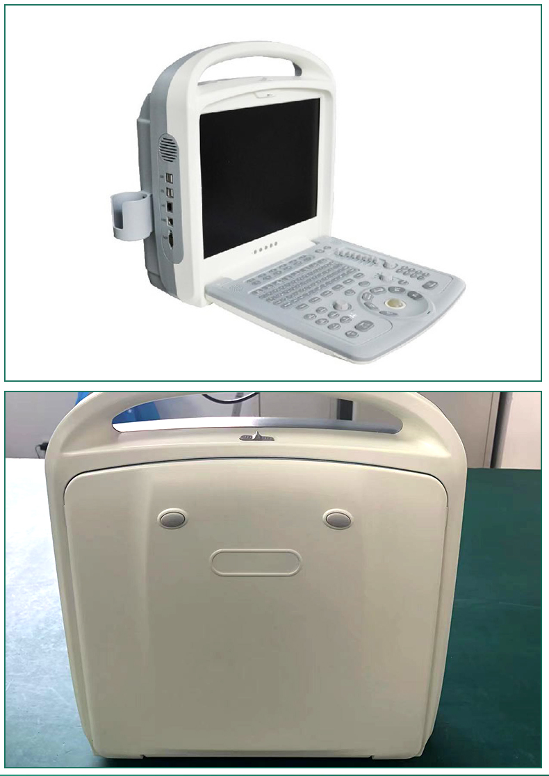 Kyle ultrasound machine manufacturer provides KR-C60 medical ultrasound machine portable color Doppler ultrasound diagnostic instrument