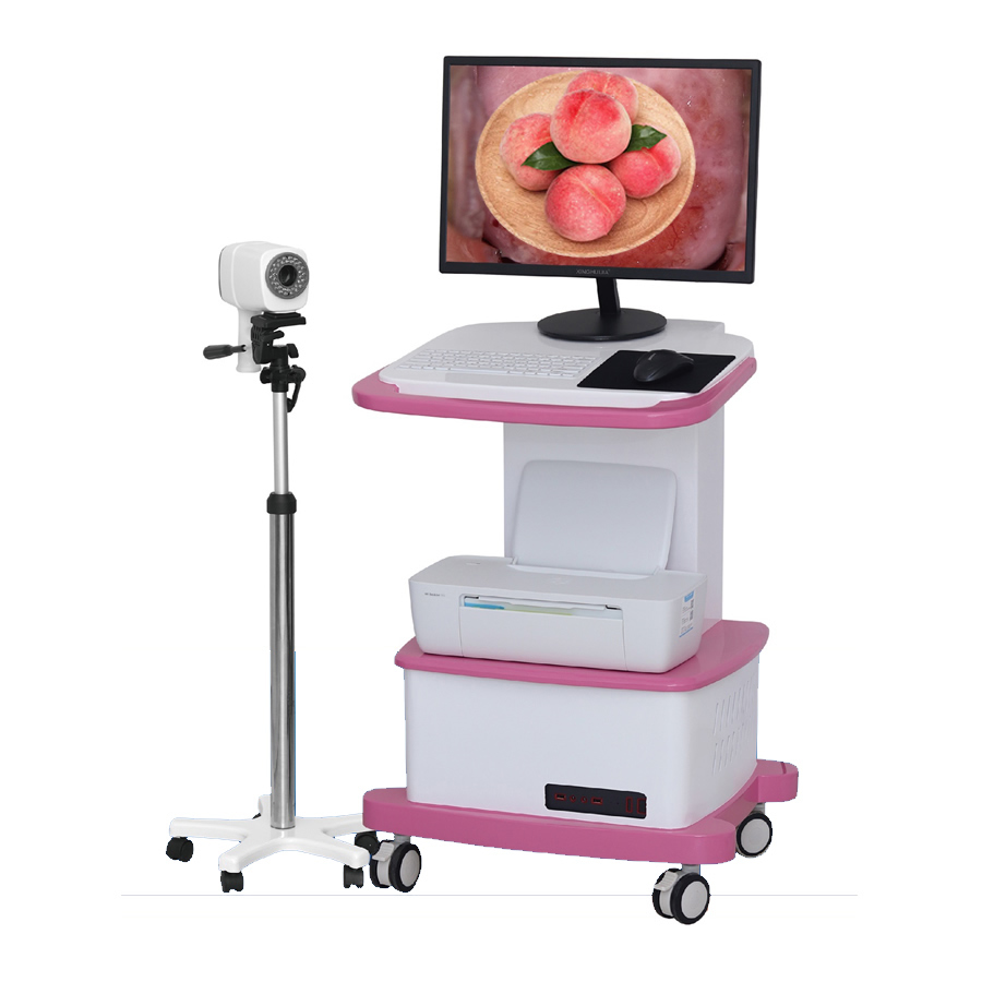 Digital electronic Colposcopy cart type gynecological vaginoscope vaginal digital imaging system