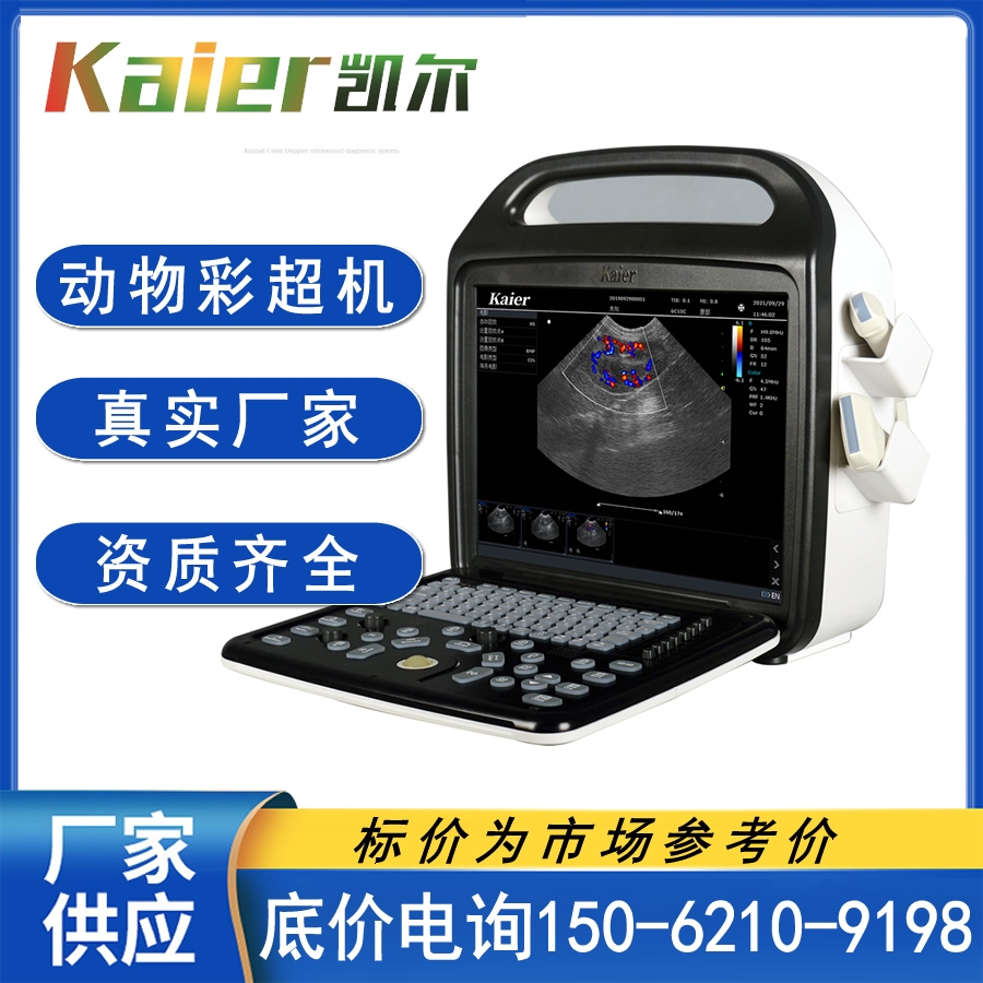 Wholesale of medical Doppler ultrasound equipment, portable B-ultrasound equipment, ultrasound diagnosis by Kaier ultrasound machine manufacturer