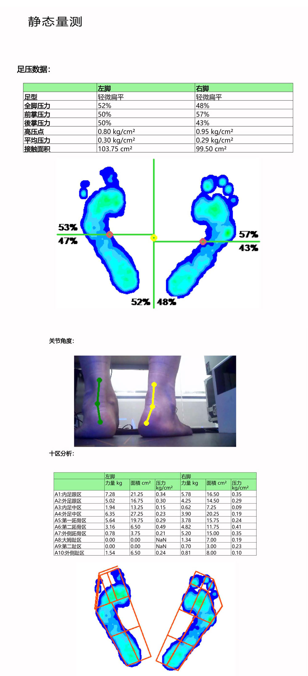 Foot pressure gait analysis equipment, foot health assessment, customized insole design and production deposit