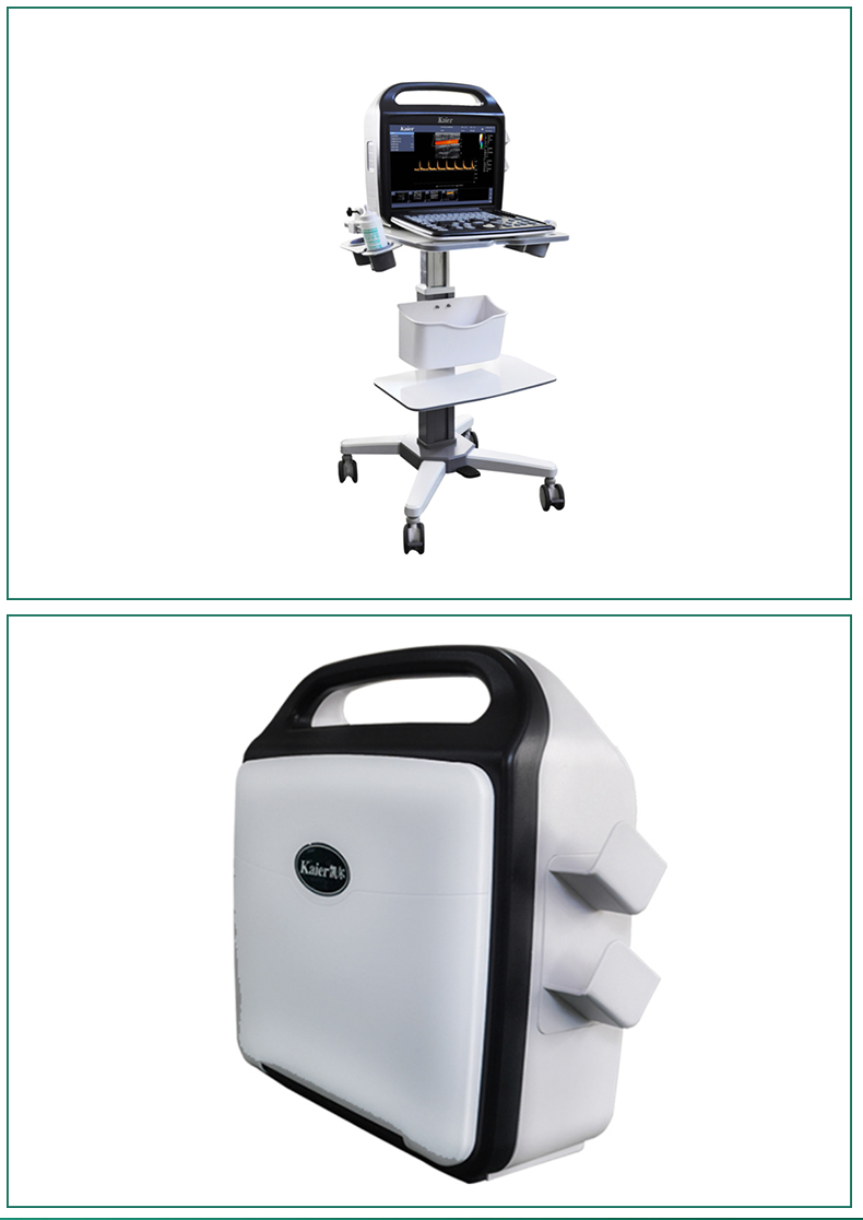 Wholesale of medical Doppler ultrasound equipment, portable B-ultrasound equipment, ultrasound diagnosis by Kaier ultrasound machine manufacturer