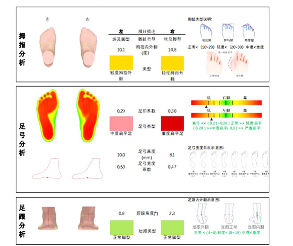 The application of 3D foot scanners in the medical field to achieve personalized treatment of foot problems