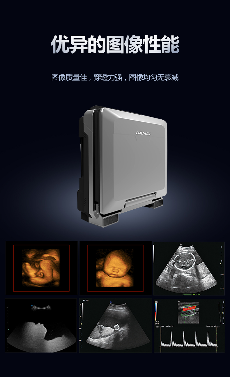 DW-PF582 Color Doppler Ultrasound Equipment for Dawei Medical Portable Ultrasound Machine