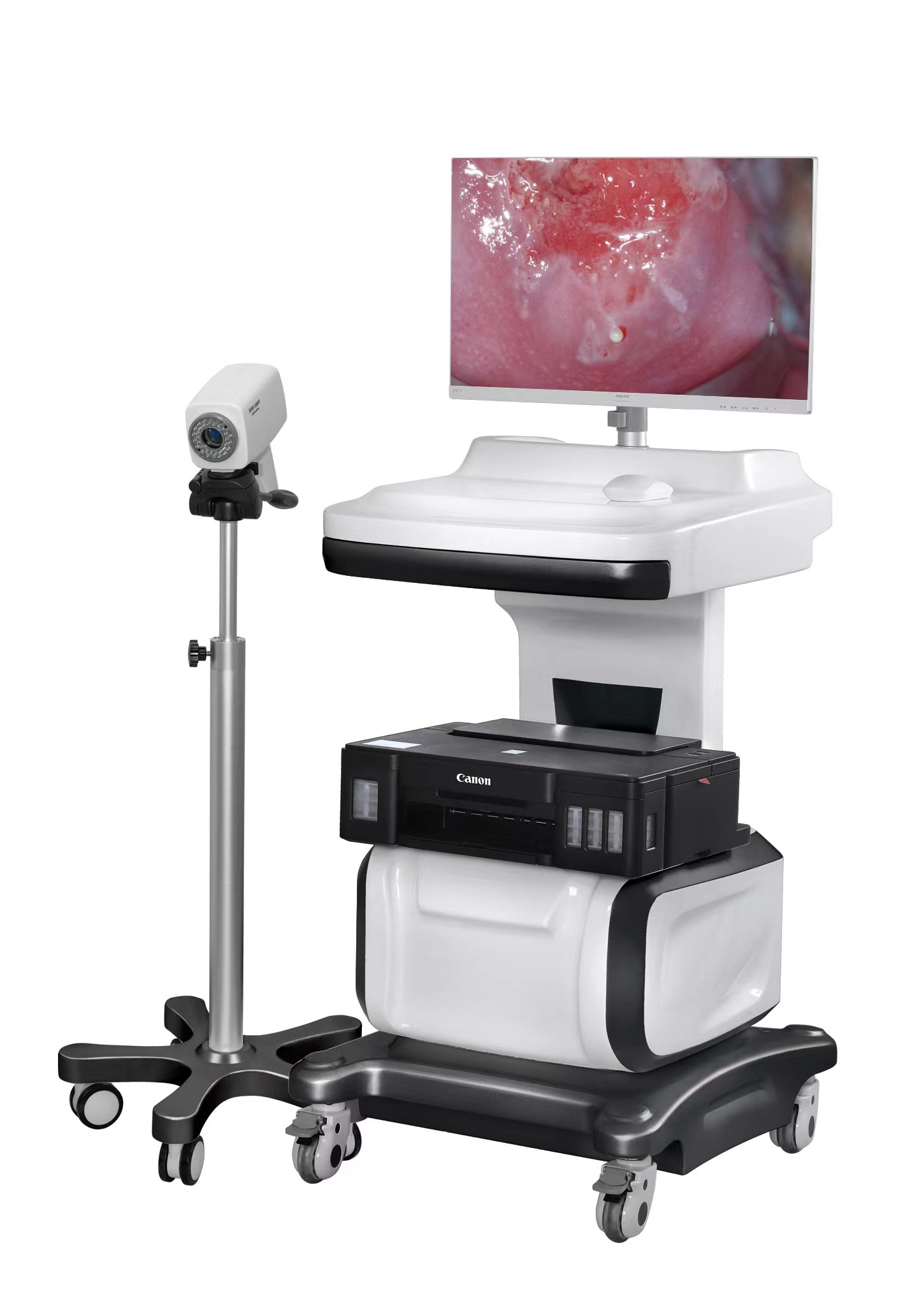 2023 digital electronic Colposcopy series gynecological cervical disease endoscopy