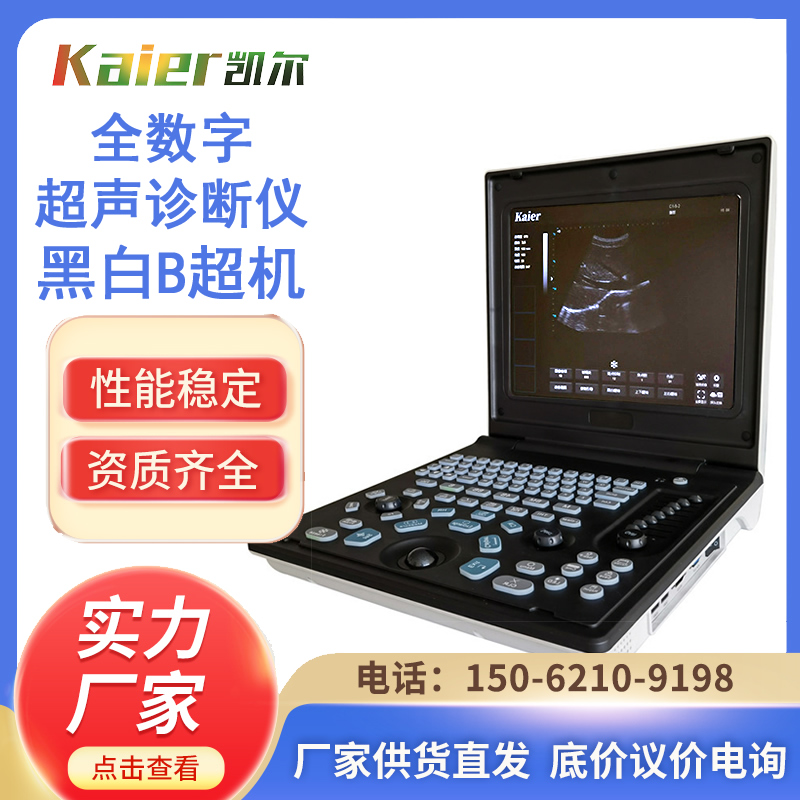 Kaier black and white ultrasound equipment manufacturer, medical all digital ultrasound diagnostic equipment, ultrasound machine domestically produced