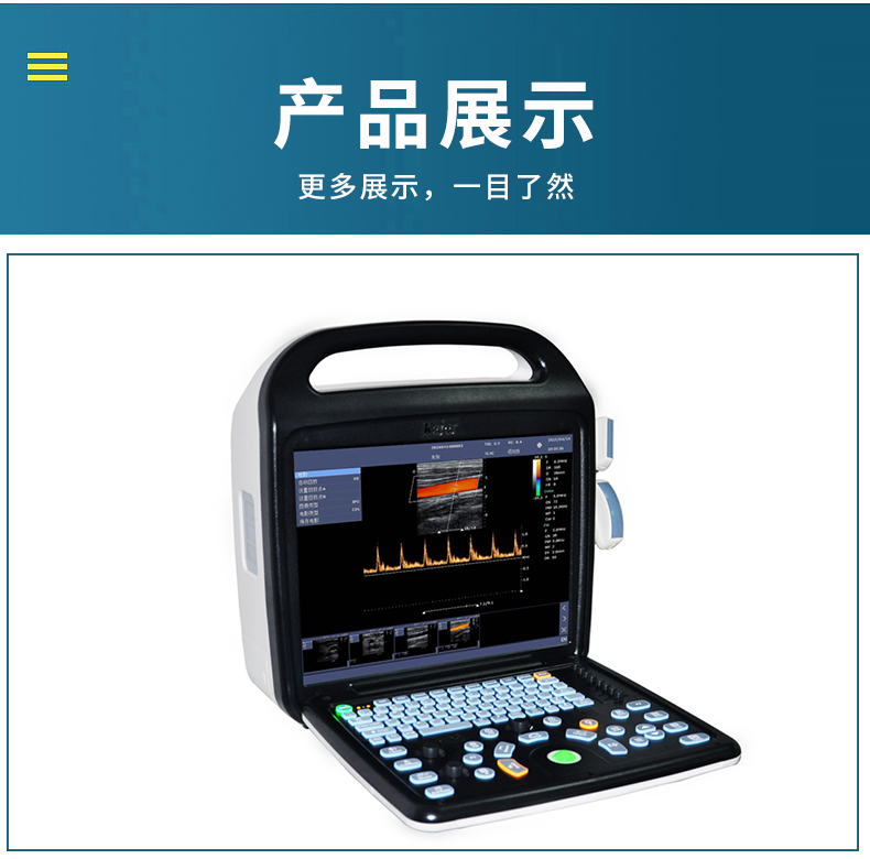 Animal ultrasound machine manufacturer provides pet B-ultrasound mobile object color Doppler ultrasound diagnosis system KR-C80