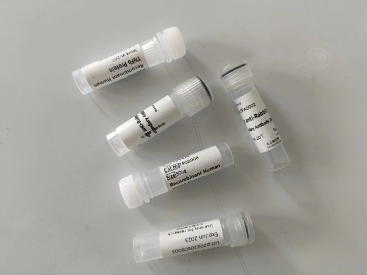 天正源生物 Fetuin-B/FETUB重组蛋白 用于 科学研究