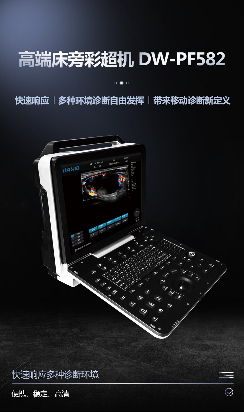 DW-PF582 Color Doppler Ultrasound Equipment for Dawei Medical Portable Ultrasound Machine