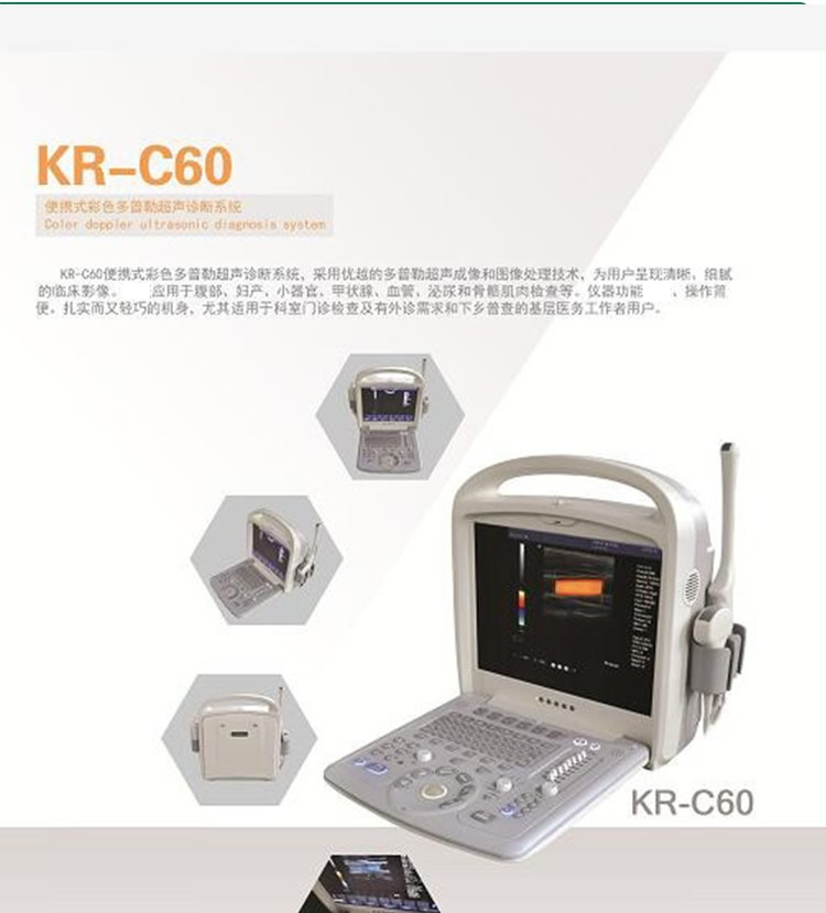 Kyle ultrasound machine manufacturer provides KR-C60 medical ultrasound machine portable color Doppler ultrasound diagnostic instrument