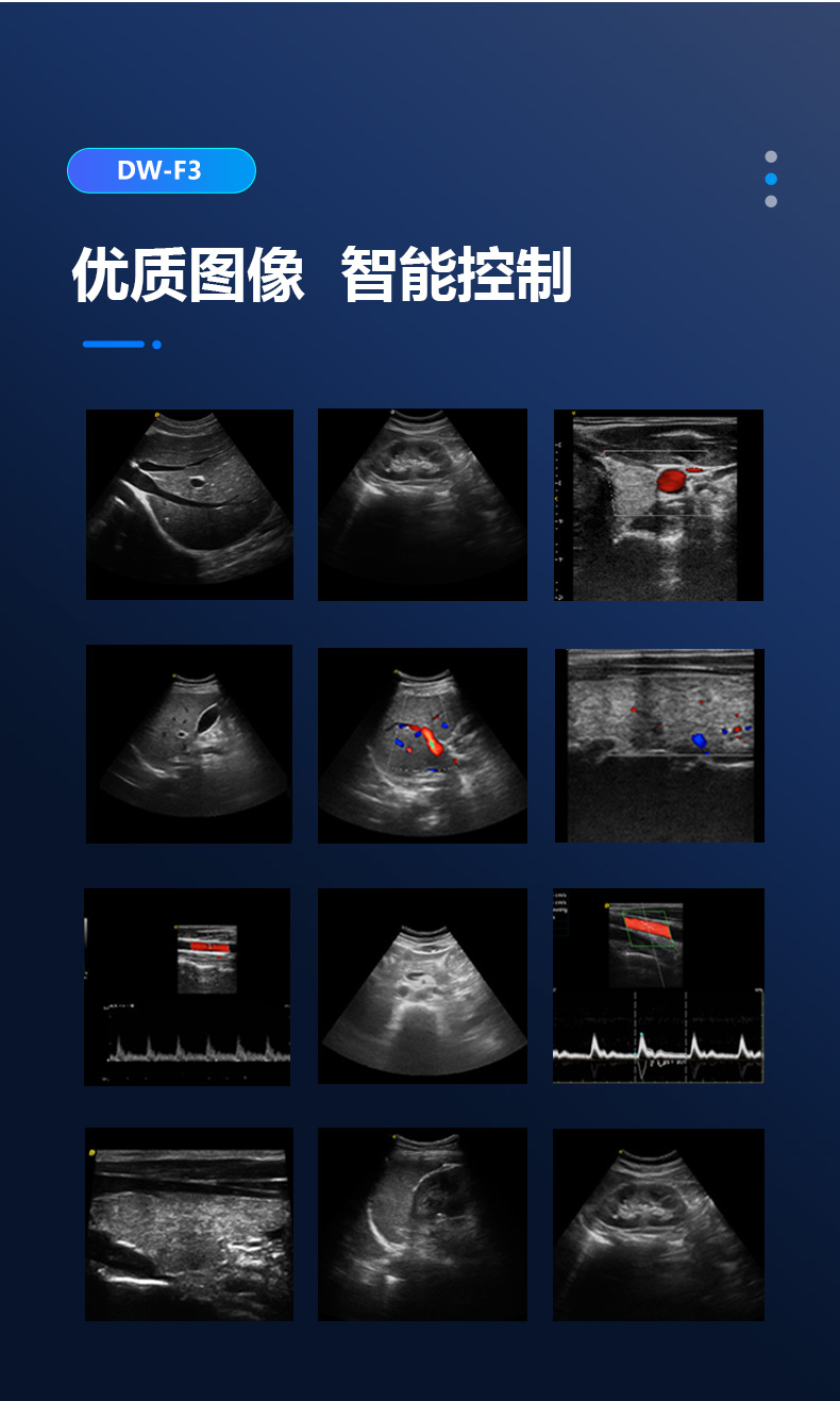 Dawei Medical DW-F3 High Cost Performance Self elevating Single Screen Color Doppler Ultrasound Machine