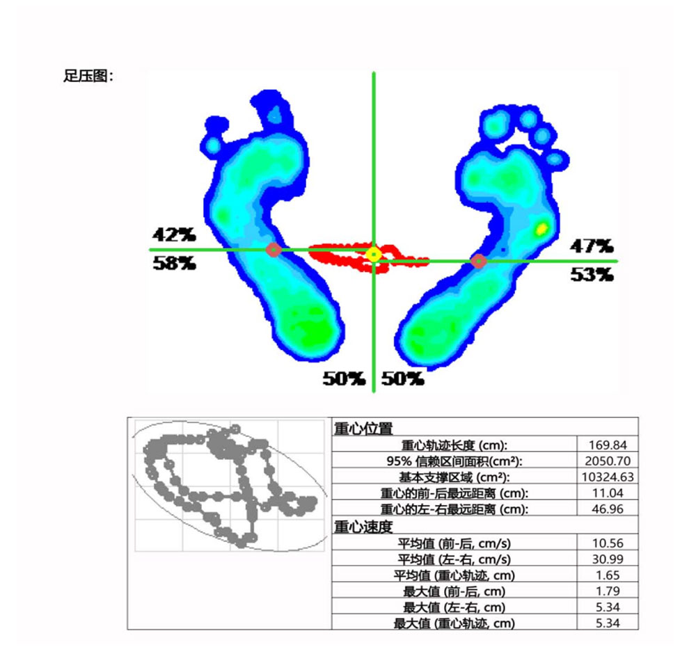 Automatic generation of analysis report for gait detection of plantar pressure plate applied to corrective insoles and hospital deposits