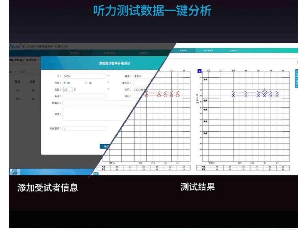 Mailisheng pure tone audiometer, adult portable hearing screening instrument, directly available in stock