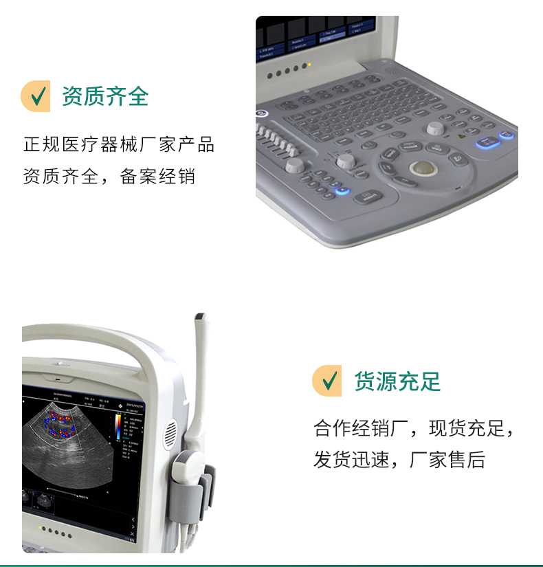 Kyle ultrasound machine manufacturer provides KR-C60 medical ultrasound machine portable color Doppler ultrasound diagnostic instrument