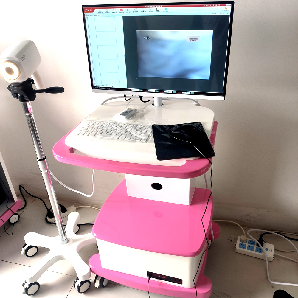 Domestic medical gynecological digital photoelectric integrated electronic Colposcopy manufacturer vaginal examination equipment