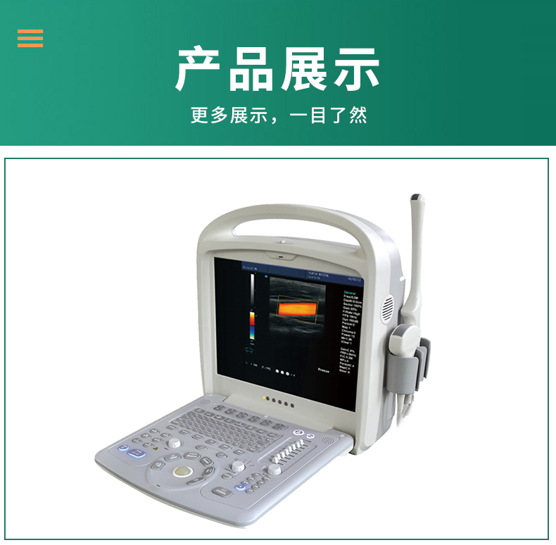 Kyle ultrasound machine manufacturer provides KR-C60 medical ultrasound machine portable color Doppler ultrasound diagnostic instrument