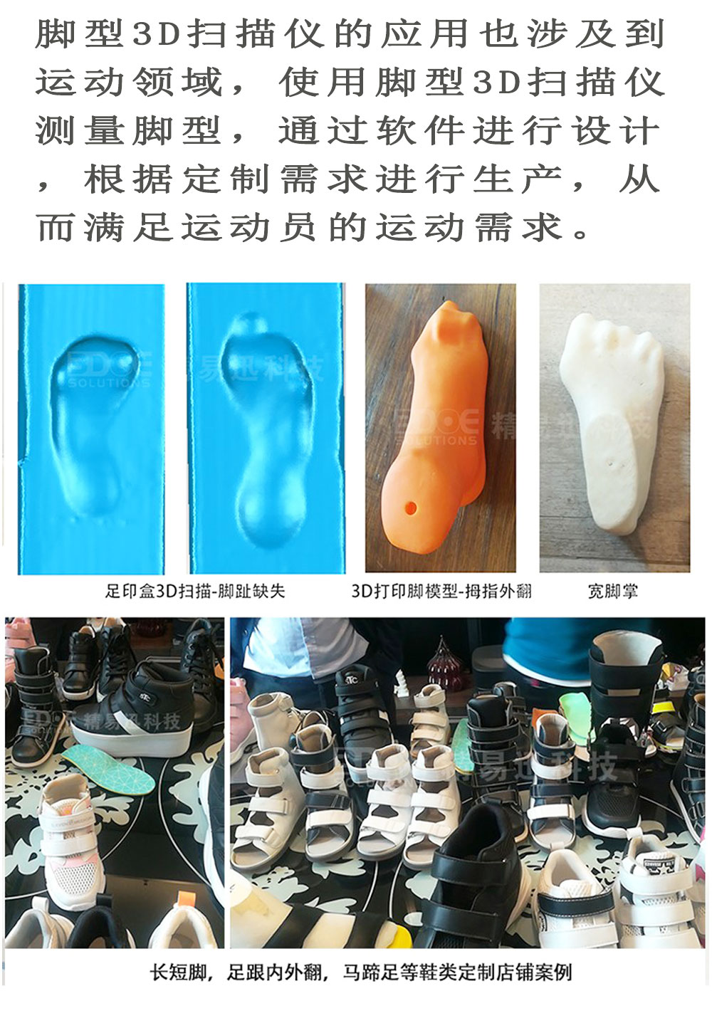 Practical 3d foot scanner to measure foot size Flat feet evaluation customized design deposit for orthotic insole