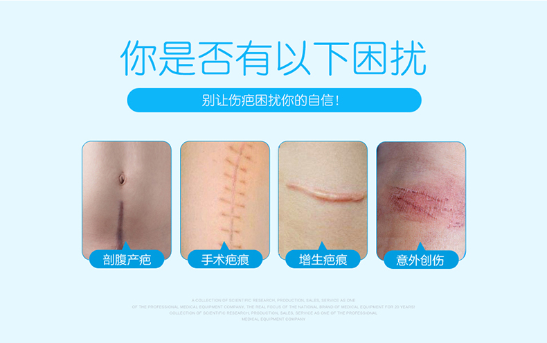 Scar patch Scar repair patch Light scar after cesarean section Medical silicone gel Jonson