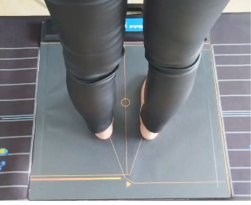 Gait analysis insole production equipment plantar pressure system foot valgus correction Flat feet evaluation deposit