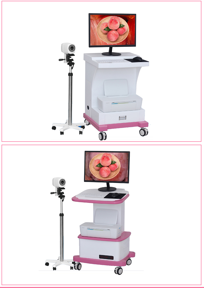 2023 digital electronic Colposcopy series gynecological cervical disease endoscopy