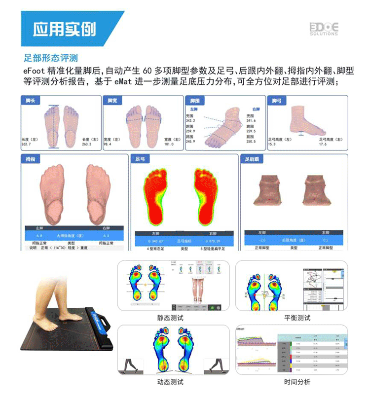 Foot data scanning and collection, plantar pressure detection, 3D foot scanner in foot health deposit