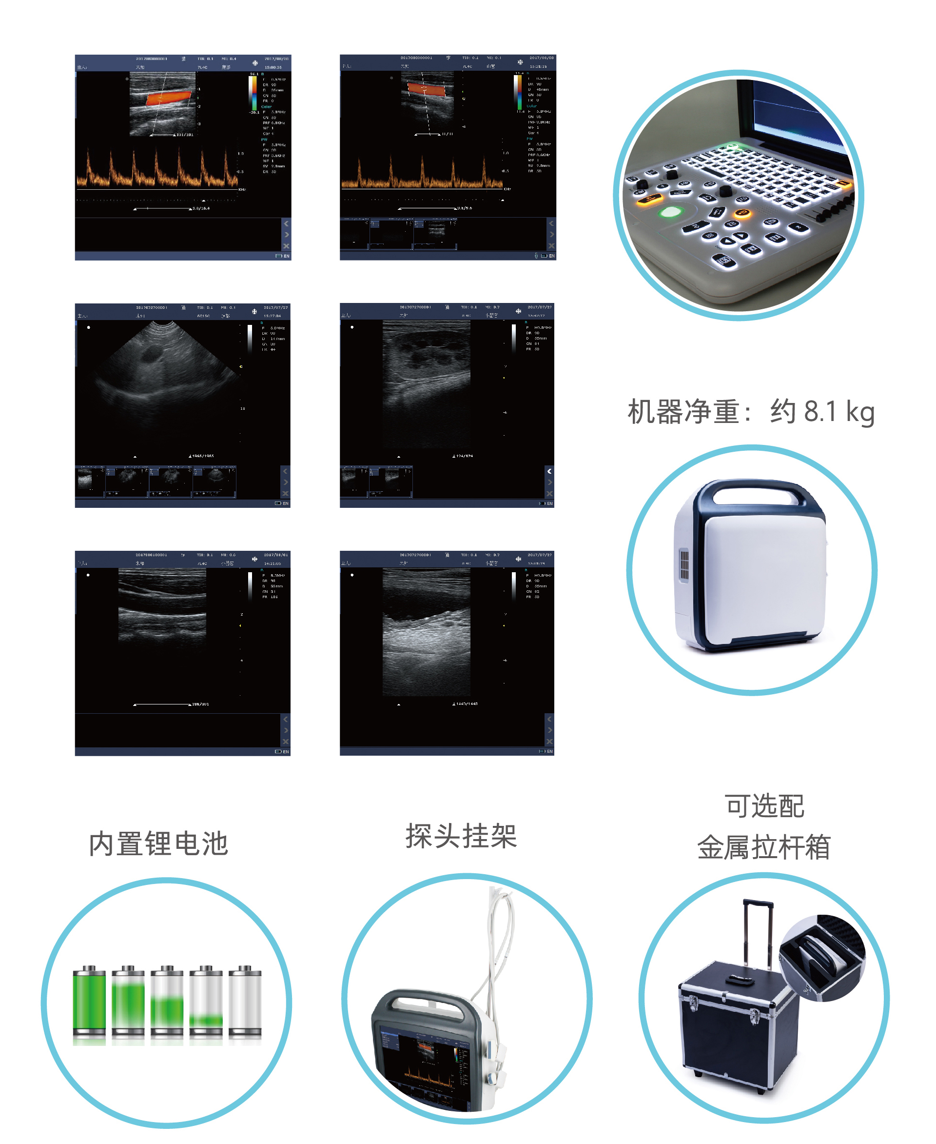 Medical color ultrasound machine, color Doppler, 15 inch LCD screen, portable color ultrasound