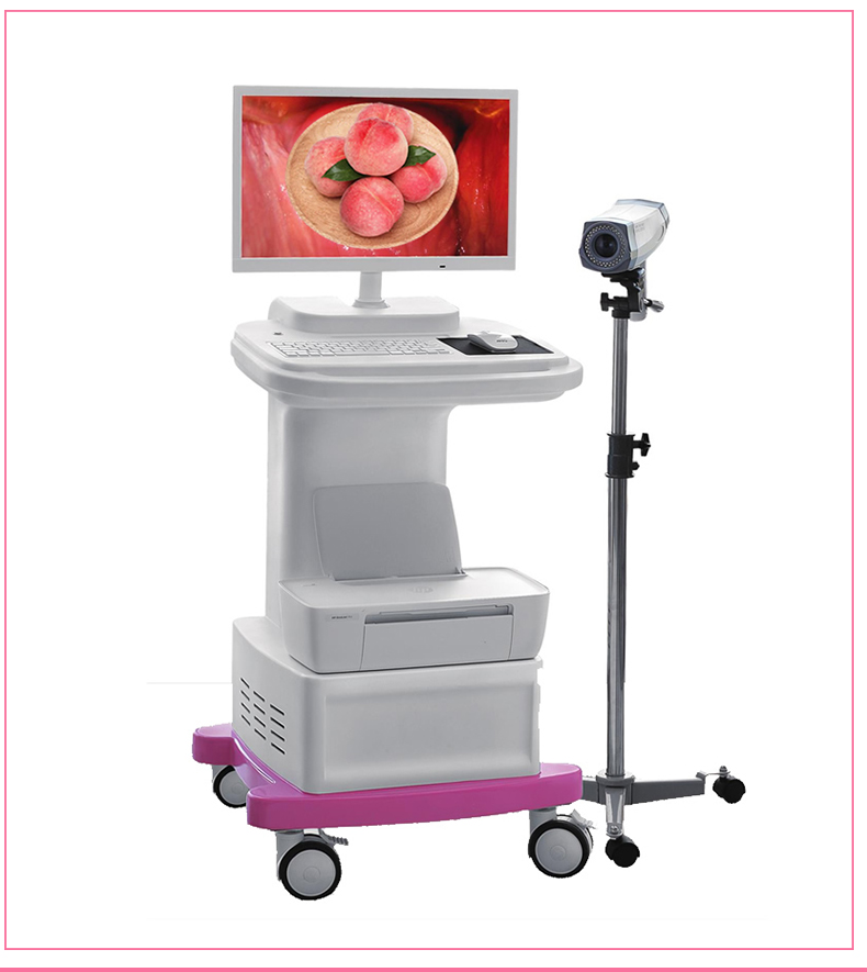 Digital electronic Colposcopy cart type gynecological vaginoscope vaginal digital imaging system