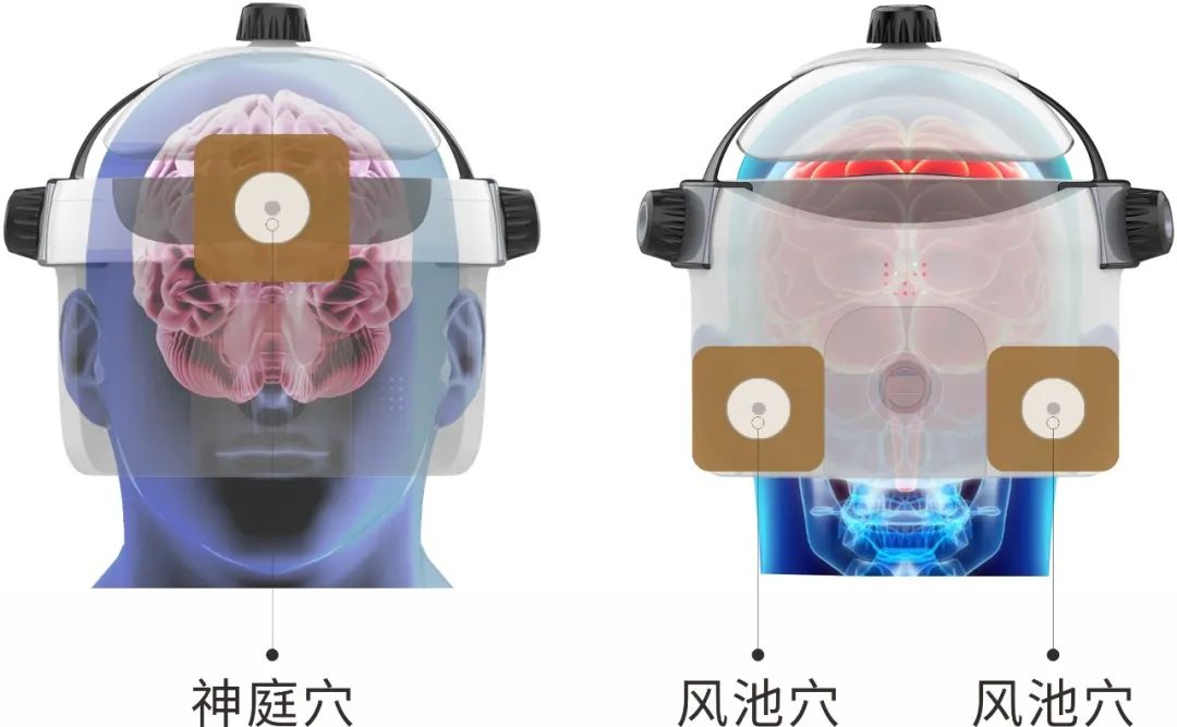 Acupoint pressure stimulation patch Transcranial magnetic brain circulation matching consumables