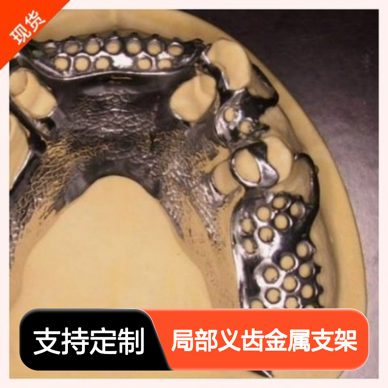 口腔科定制式局部义齿金属支架可摘局部义齿前进品牌医用耗材