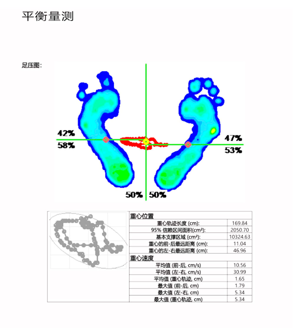 Foot pressure sensor gait analysis equipment for correcting insoles Customized foot health assessment deposit