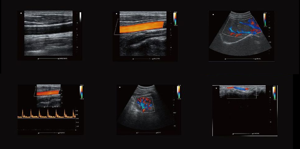 Kaier Medical Bedside Portable Color Doppler Ultrasound Manufacturer: Heart Organ and Vascular Doppler Ultrasound Blood Flow Analysis Instrument