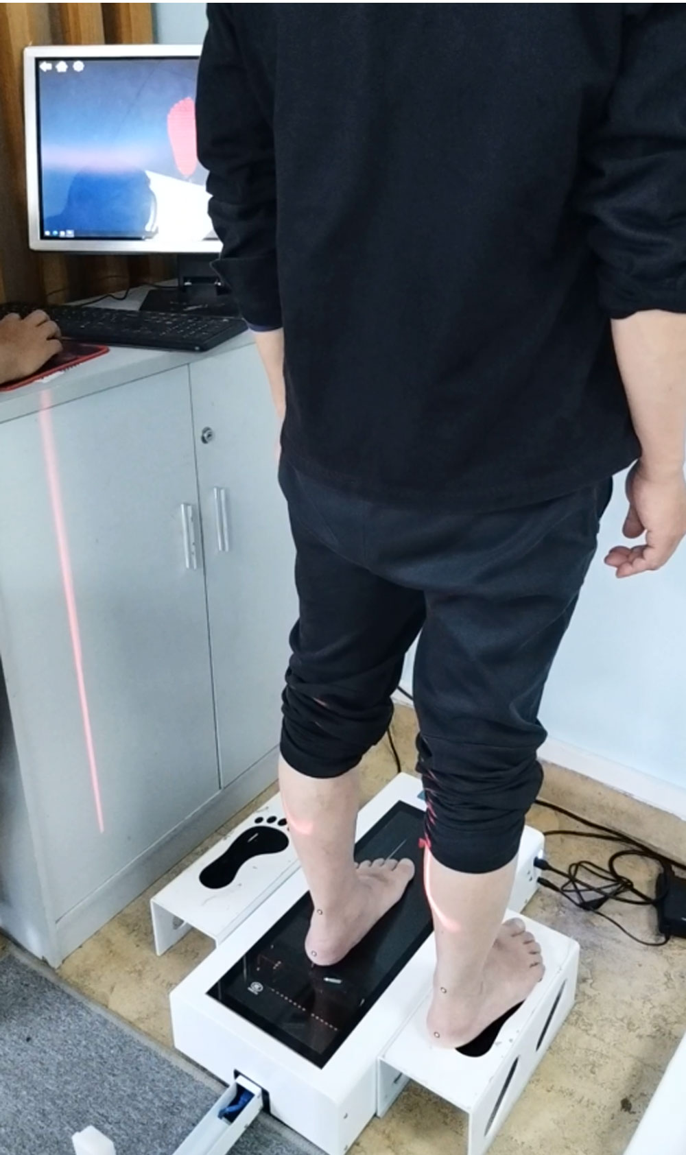 Plantar 3D scanner correction insole foot measurement and analysis arch height, heel turnover deposit