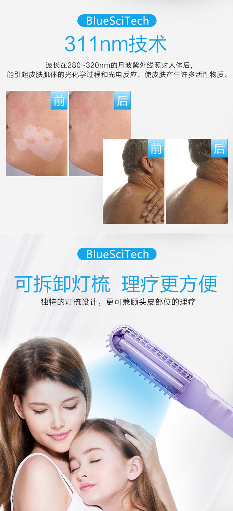 Skin disease vitiligo medical household Philips UVB ultraviolet light therapy equipment