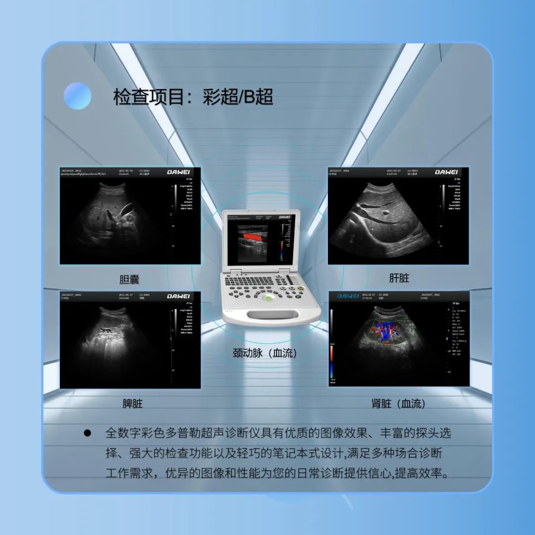 Dawei Medical Public Health Examination Color Ultrasound Machine Portable Laptop Ultrasound Visiting Community Examination Color Ultrasound Equipment