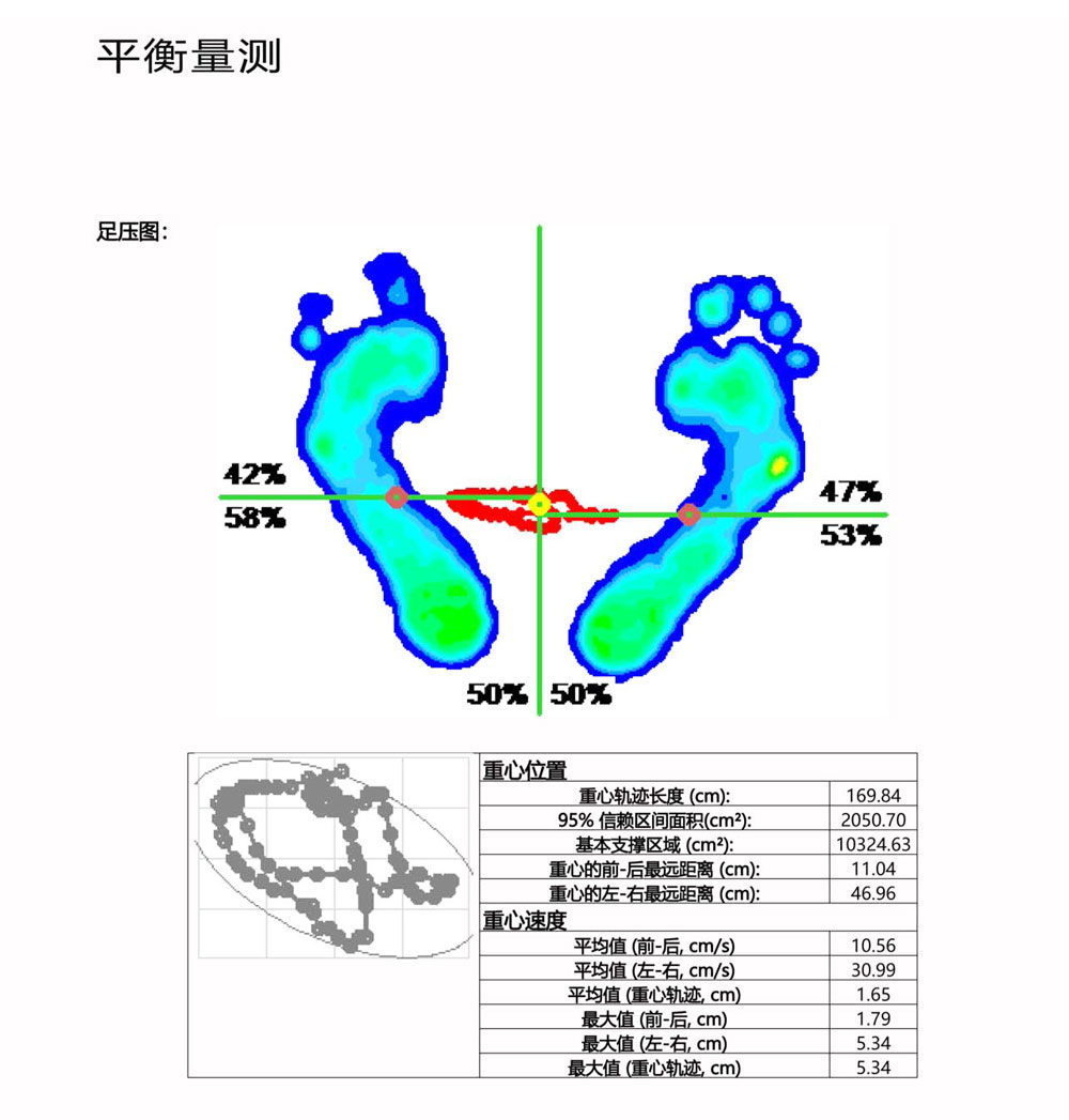 Foot pressure gait analysis equipment, foot health assessment, customized insole design and production deposit