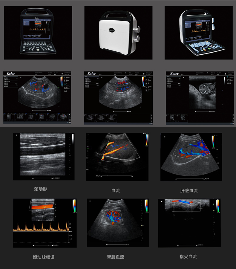 Animal ultrasound machine manufacturer provides pet B-ultrasound mobile object color Doppler ultrasound diagnosis system KR-C80