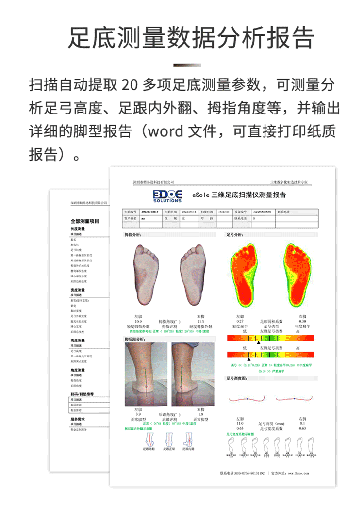 The application of foot 3D scanner in foot print scanning and correction insole customization deposit