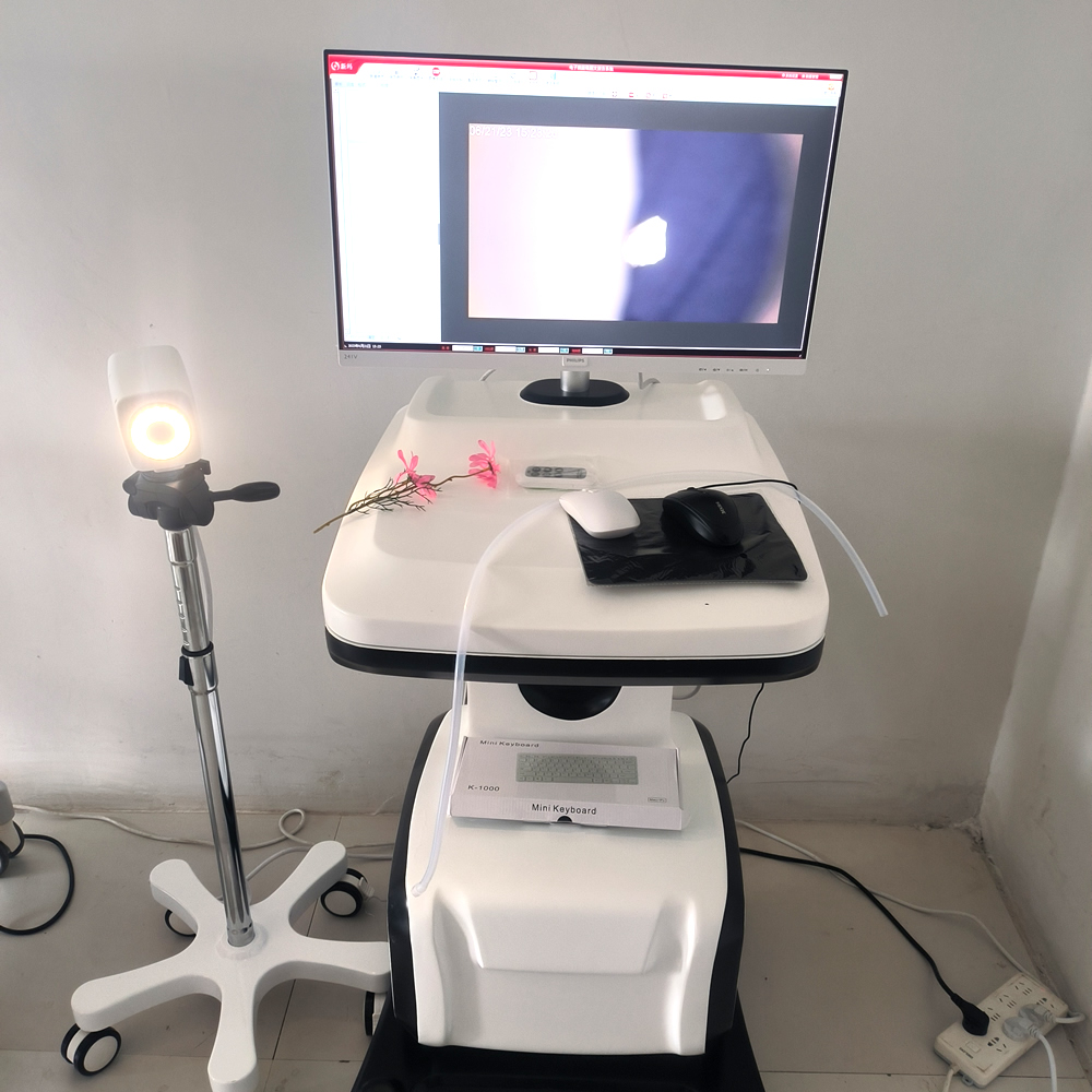 Digital electronic Colposcopy standard gynecological medical high-definition endoscope 2023 product trends