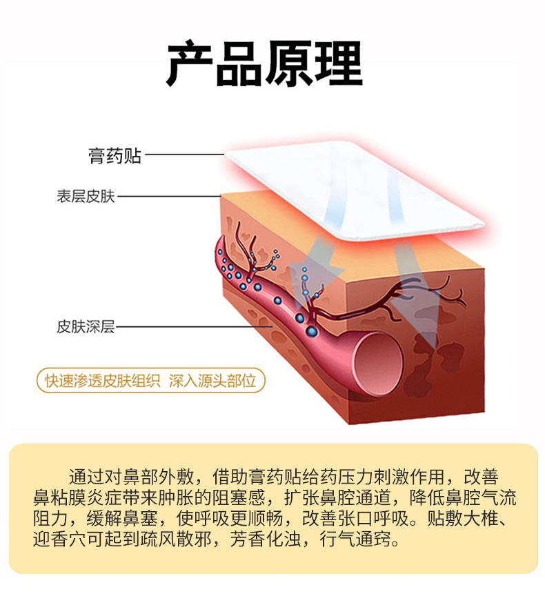 Acupoint pressure stimulation patch, rhinitis patch, cold patch, moxibustion therapy, wind dispersing, cold dispelling, non stick skin OEM OEM OEM customization