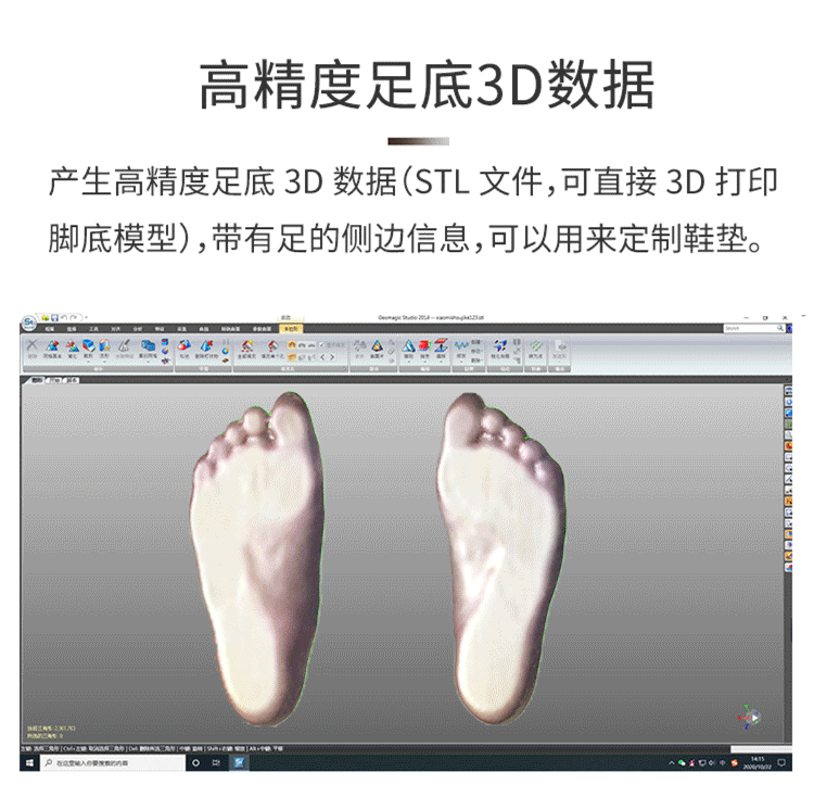 The application of foot 3D scanner in foot print scanning and correction insole customization deposit