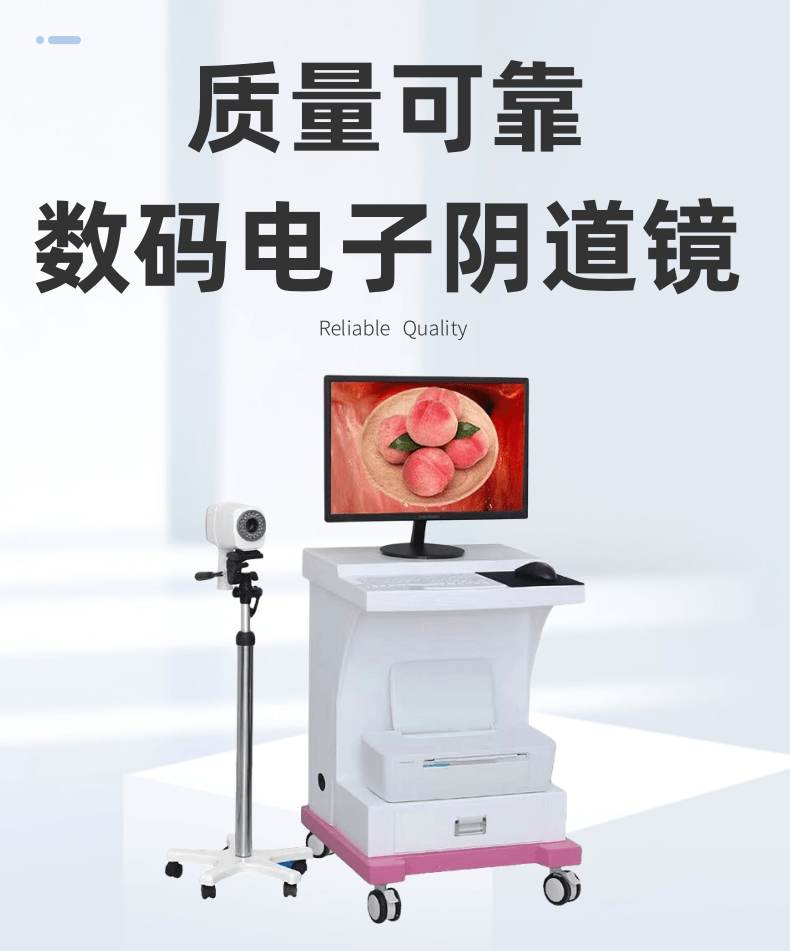 Domestic medical gynecological high-definition digital electronic Colposcopy manufacturer