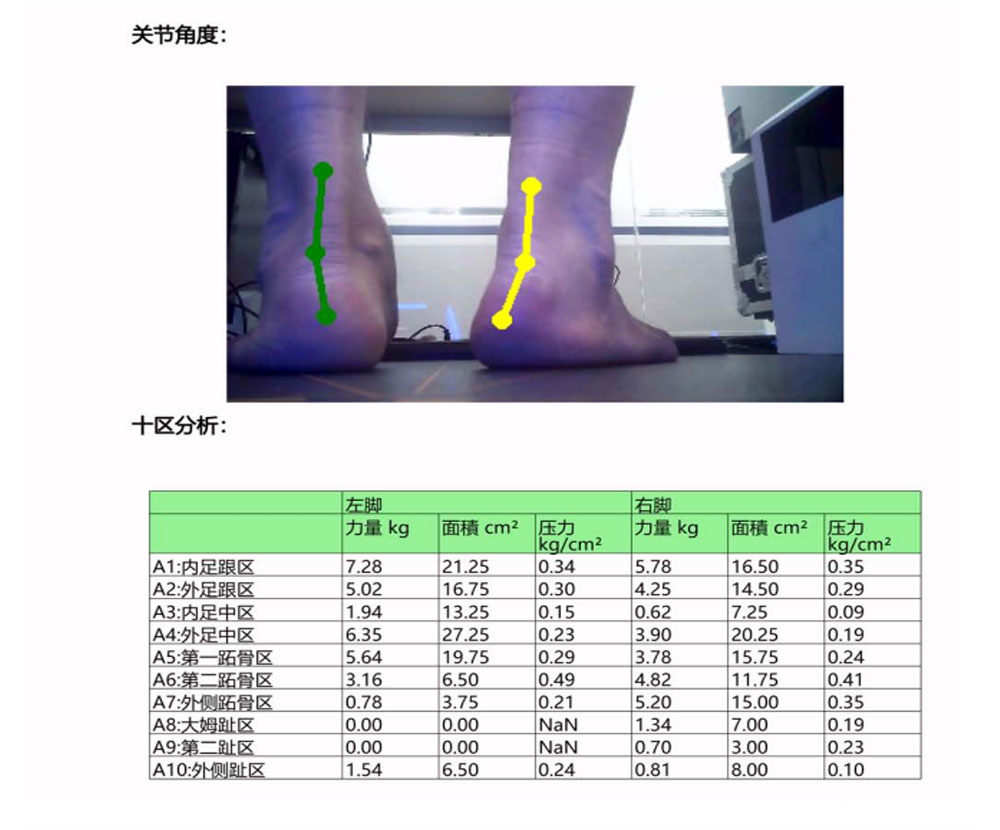 Automatic generation of analysis report for gait detection of plantar pressure plate applied to corrective insoles and hospital deposits