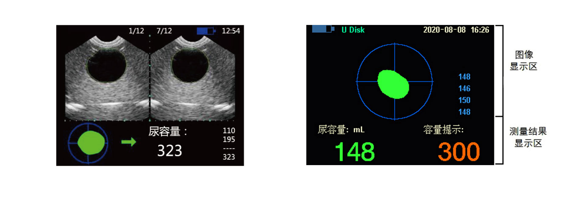 Kaixin BVT02 portable and compact ultrasound bladder scanner/bladder volume measuring instrument