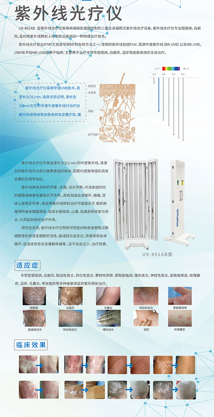 Skin disease vitiligo medical household Philips UVB ultraviolet light therapy equipment