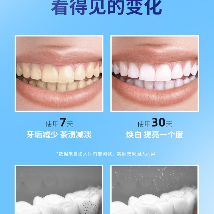 Qinlu Probiotic Toothpaste Direct Supply Special Vehicle Delivery OEM Enterprise Delivery