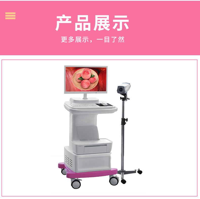 2023 digital electronic Colposcopy series gynecological cervical disease endoscopy